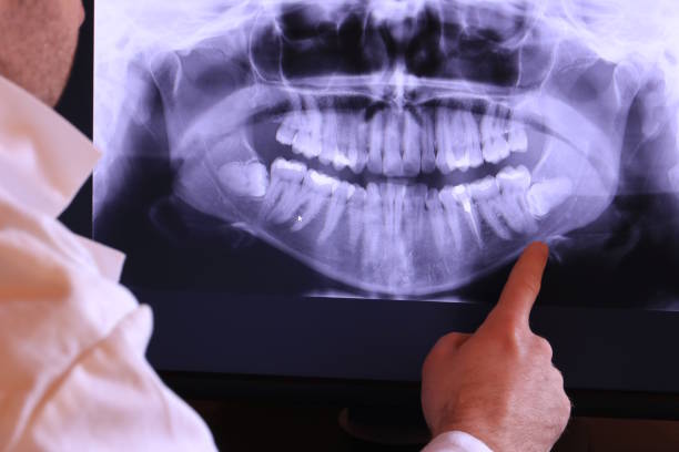 Best Pediatric Emergency Dentist in Loma Ri, CA